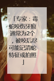 专家：毒蛇咬伤牙痕通常为2个，被咬后尽可能记清蛇特征或拍照