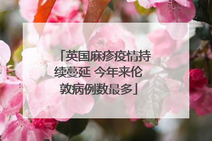英国麻疹疫情持续蔓延 今年来伦敦病例数最多